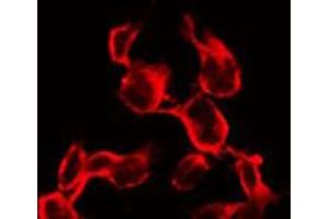 ABIN6267337 staining 293 by IF/ICC. (IGF1R 抗体  (pTyr1161))