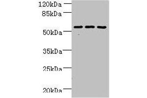 Western blot All lanes: ZNF19 antibody at 4 μg/mL Lane 1: Mouse liver tissue Lane 2: MDA-MB-231 whole cell lysate Lane 3: HepG2 whole cell lysate Secondary Goat polyclonal to rabbit IgG at 1/10000 dilution Predicted band size: 53, 52 kDa Observed band size: 53 kDa (ZNF19 抗体  (AA 1-200))