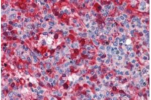 Human Spleen: Formalin-Fixed, Paraffin-Embedded (FFPE) (WDR20 抗体  (AA 1-570))