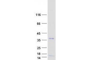 Western Blotting (WB) image for Oligodendrocyte Transcription Factor 3 (OLIG3) protein (Myc-DYKDDDDK Tag) (ABIN2727902)