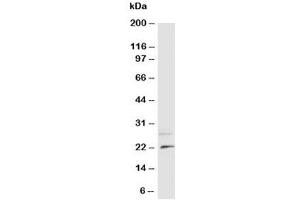 Western blot testing of NGF antibody and rat brain tissue lysate (Nerve Growth Factor 抗体  (N-Term))