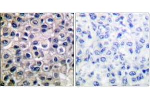 Immunohistochemistry (IHC) image for anti-Matrix Metallopeptidase 14 (Membrane-inserted) (MMP14) (AA 471-520) antibody (ABIN1533346)