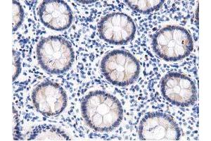 Immunohistochemical staining of paraffin-embedded Human colon tissue using anti-DNAJA2 mouse monoclonal antibody. (DNAJA2 抗体)