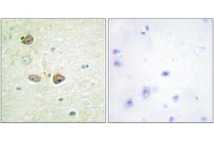 Immunohistochemistry analysis of paraffin-embedded human brain tissue, using 5-HT-1B Antibody. (5HT1B Receptor 抗体  (AA 201-250))