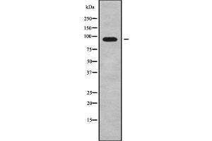 Western blot analysis of ADAM29 using COLO205 whole cell lysates (ADAM29 抗体  (C-Term))