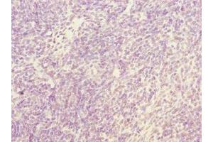 Immunohistochemistry of paraffin-embedded human thymus tissue using ABIN7161944 at dilution of 1:100 (NFYB 抗体  (AA 1-207))