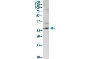 CENPH MaxPab rabbit polyclonal antibody. (CENPH 抗体  (AA 1-247))