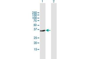 Western Blot analysis of MSX2 expression in transfected 293T cell line by MSX2 MaxPab polyclonal antibody. (Msx2/Hox8 抗体  (AA 1-267))
