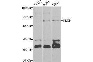 Western blot analysis of extracts of various cell lines, using FLCN antibody (ABIN5973885) at 1/1000 dilution. (FLCN 抗体)