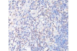 Immunohistochemistry of paraffin-embedded Human appendix using CFL1 Polyclonal Antibody at dilution of 1:100 (40x lens). (Cofilin 抗体)