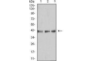 Western Blotting (WB) image for anti-beta-1,3-Glucuronyltransferase 1 (Glucuronosyltransferase P) (B3GAT1) (AA 193-334) antibody (ABIN5542603)