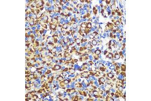 Immunohistochemistry of paraffin-embedded Rat ovary using FGF2 Rabbit pAb (ABIN3020744, ABIN3020745, ABIN3020746 and ABIN6213702) at dilution of 1:100 (40x lens). (FGF2 抗体  (AA 143-288))