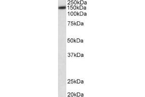 Western Blotting (WB) image for anti-ATPase, Ca++ Transporting, Plasma Membrane 1 (ATP2B1) (AA 312-327) antibody (ABIN870665)