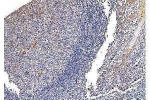 IHC analysis of GFPT1 using anti-GFPT1 antibody (ABIN7602887). (GFPT1 抗体  (C-Term))