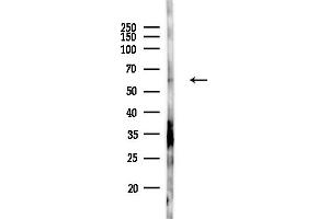 anti-Guanylate Cyclase 1, Soluble, beta 2 (GUCY1B2) antibody