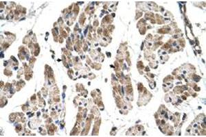 Immunohistochemical staining (Formalin-fixed paraffin-embedded sections) of human muscle with ITGB1BP2 polyclonal antibody  at 4-8 ug/mL working concentration.