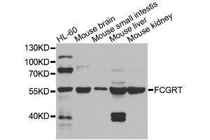 Western blot analysis of extracts of various cell lines, using FCGRT antibody (ABIN5995932) at 1/1000 dilution. (FcRn 抗体)