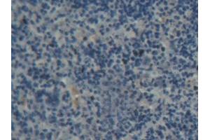 Immunohistochemistry (IHC) image for anti-ATP-Binding Cassette, Sub-Family B (MDR/TAP), Member 8 (ABCB8) (AA 468-714) antibody (ABIN5013187)