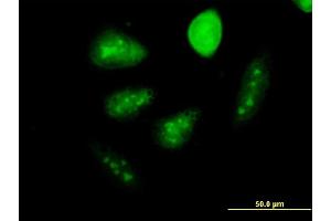 Immunofluorescence of monoclonal antibody to GCM1 on HeLa cell. (GCM1 抗体  (AA 108-166))