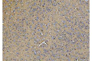 IHC analysis of ATP1B1 using anti-ATP1B1 antibody (ABIN7602014).