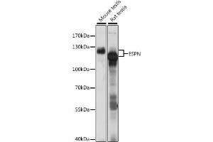Western blot analysis of extracts of various cell lines, using ESPN antibody (ABIN7267008) at 1:1000 dilution. (Espin 抗体  (AA 585-854))