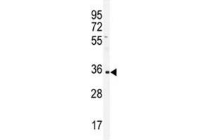 Western blot analysis of IGHA1 antibody and CEM lysate. (IGHA1 抗体  (AA 257-286))