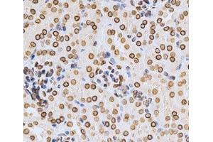 Immunohistochemistry of paraffin-embedded Mouse kidney using Lamin A/C Polyclonal Antibody at dilution of 1:200 (40x lens). (Lamin A/C 抗体)