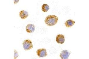 Immunohistochemistry (IHC) image for anti-Interleukin 27 (IL27) (N-Term) antibody (ABIN1031413)