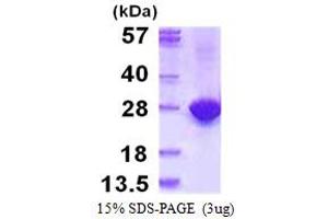 SDS-PAGE (SDS) image for Myosin Light Chain 4, Alkali, Atrial, Embryonic (MYL4) (AA 1-197) protein (His tag) (ABIN667619)