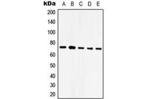 Western blot analysis of GRP75 expression in HeLa (A), NIH3T3 (B), SP2/0 (C), mouse brain (D), rat brain (E) whole cell lysates. (HSPA9 抗体  (C-Term))