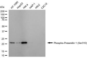 Western blotting analysis using phospho-presenilin 1 (Ser310) antibody (ABIN7799896). (Recombinant Presenilin 1 抗体  (pSer310))