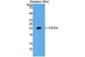 Detection of Recombinant CD3e, Human using Polyclonal Antibody to T-Cell Surface Glycoprotein CD3 Epsilon (CD3e) (CD3 epsilon 抗体  (AA 28-185))