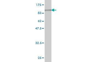 Western Blot detection against Immunogen (91. (GAD 抗体  (AA 1-594))