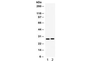Western blot testing of 1) rat kidney and 2) mouse kidney lysate with IGFBP1 antibody. (IGFBPI 抗体)