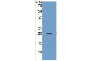 Western Blotting (WB) image for Matrix Metallopeptidase 9 (Gelatinase B, 92kDa Gelatinase, 92kDa Type IV Collagenase) (MMP9) ELISA Kit (ABIN6730931)