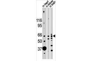Western blot analysis of ACVR2B polyclonal antibody  in mouse heart, kidney and brain lysates (35 ug/lane). (ACVR2B 抗体  (N-Term))