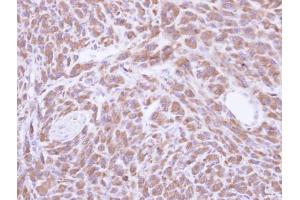IHC-P Image Immunohistochemical analysis of paraffin-embedded U87 xenograft, using PCMT1, antibody at 1:500 dilution. (PCMT1 抗体)