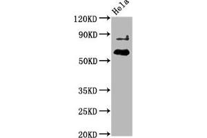 Western Blot Positive WB detected in Hela whole cell lysate All lanes Phospho-AKT1 antibody at 2. (Recombinant AKT1 抗体  (pThr450))