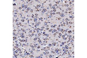 IHC analysis of MPPB/PMPCB using anti-MPPB/PMPCB antibody (ABIN7600758). (PMPCB 抗体  (AA 23-479))
