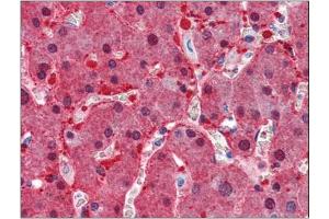 Immunohistochemistry Image: Human Liver: Formalin-Fixed, Paraffin-Embedded (FFPE) (ASS1 抗体  (Internal Region))