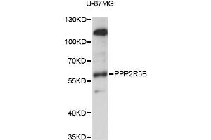 Western blot analysis of extracts of U-87MG cells, using PPP2R5B antibody (ABIN6293293) at 1:1000 dilution. (PPP2R5B 抗体)