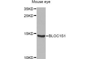 Western blot analysis of extracts of mouse eye, using BLOC1S1 Antibody (ABIN5975442) at 1/1000 dilution. (BLOC1S1 抗体)