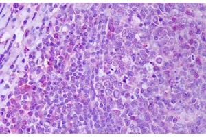 Anti-RANKL antibody IHC staining of human tonsil, germinal center.