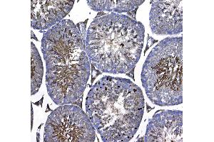 Immunohistochemistry (IHC) image for anti-Glutathione S-Transferase mu 3 (Brain) (GSTM3) (AA 93-206) antibody (ABIN5693252)