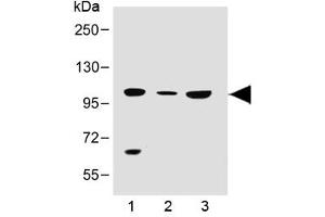 Western blot testing of human 1) 293T/17, 2) brain and 3) K562 lysate with SLC14A2 antibody at 1:500. (Solute Carrier Family 14 (Urea Transporter, Kidney) Member 2 (SLC14A2) (AA 42-76) 抗体)
