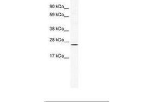 anti-BRF1, RNA polymerase III transcription initiation factor subunit (BRF1) (C-Term) antibody
