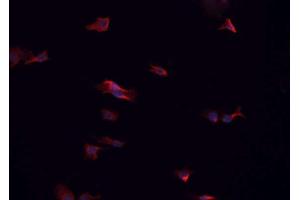 ABIN6266575 staining HeLa cells by IF/ICC. (Cytokeratin 7 抗体  (C-Term))