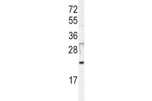Western blot analysis of HRAS antibody in Jurkat lysate. (HRAS 抗体  (AA 104-128))