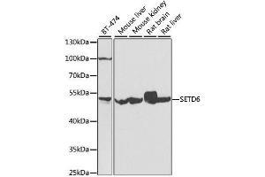 Western blot analysis of extracts of various cell lines, using SETD6 antibody. (SETD6 抗体  (AA 301-473))