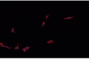 Immunofluorescence (fixed cells) (IF/ICC) image for anti-Potassium Large Conductance Calcium-Activated Channel, Subfamily M, beta Member 1 (KCNMB1) antibody (ABIN6262754)